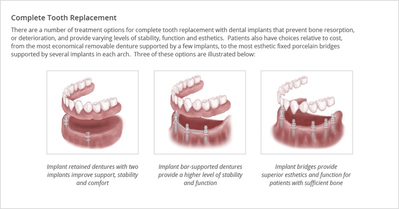 treatment options