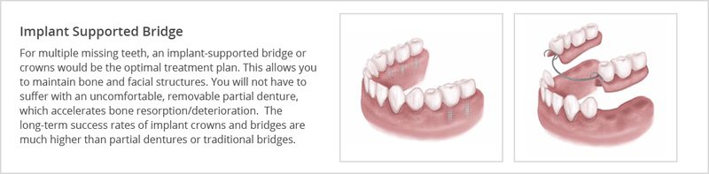 treatment options